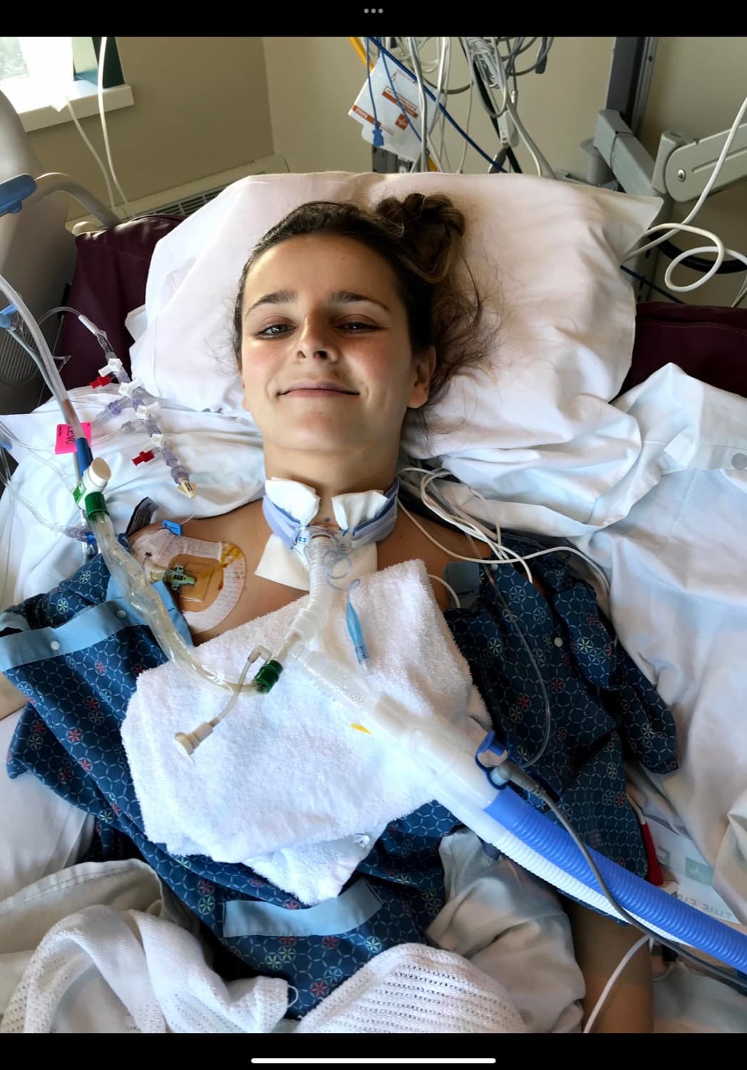 Rebecca smiling in the hospital with a ventilator and neck brace.